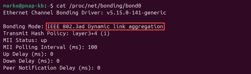 Bonding mode set to IEEE 802.3ad Dynamic link aggregation.